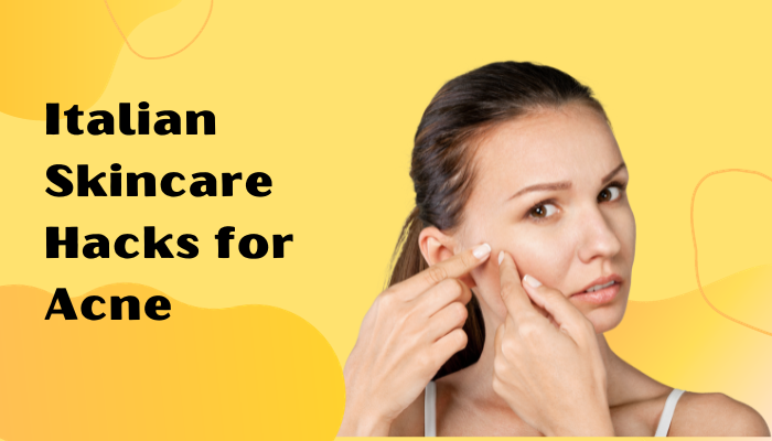 Italian Skincare Hacks for Acne